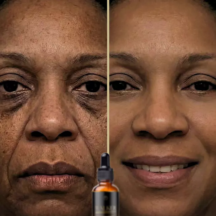 Walker Skin Protect Reviews